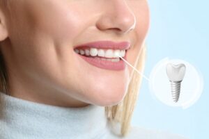Why Do I Feel Sensitivity in My Dental Implant?