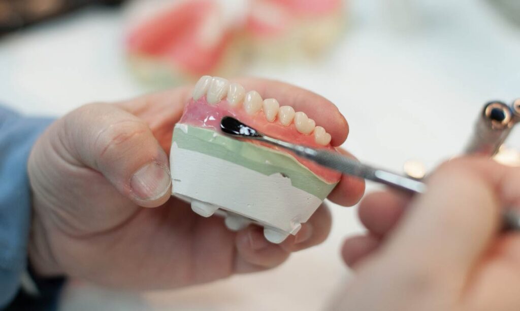 What Are Dentures Made Of: A Detailed Look at the Materials That Make Up Dentures